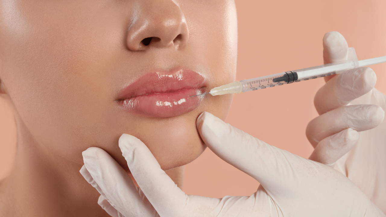 How Much Lip Fillers Cost