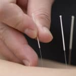 acupuncture-schools